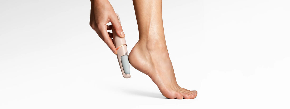 best electric callus removers