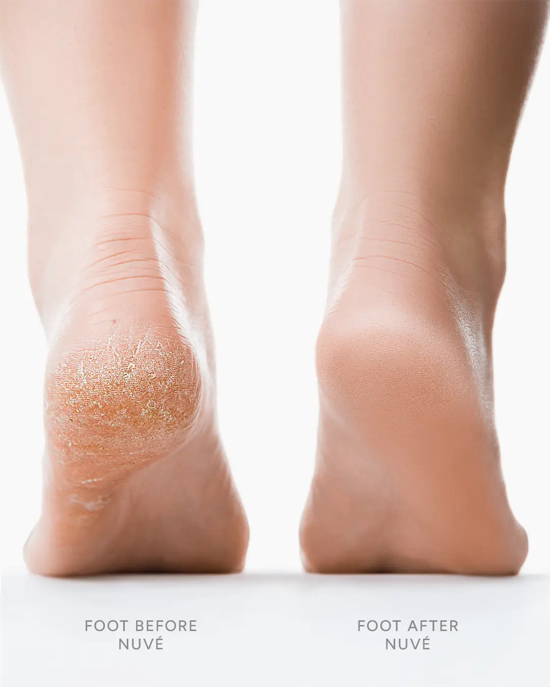 Avant / Après SilkFeet™