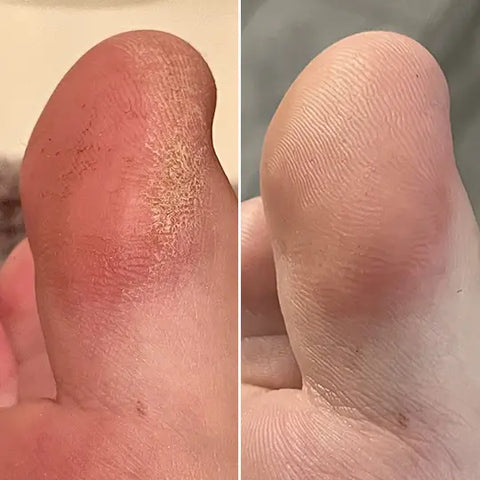 Rina A. before and after results