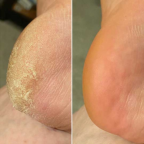Sandra M. before and after results